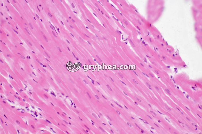 Mucle cardiaque CL x160 - gryphea.com